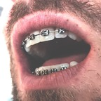 Free access to (braces) Leaked OnlyFans 

 profile picture