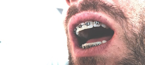 Header of braces